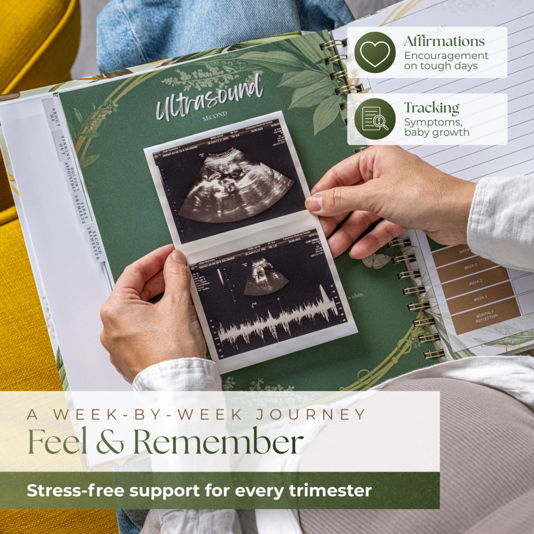 MallowMarsh™ Pregnancy Journal keepsake with baby shoes and newborn photos